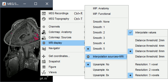 display_mri3d.gif