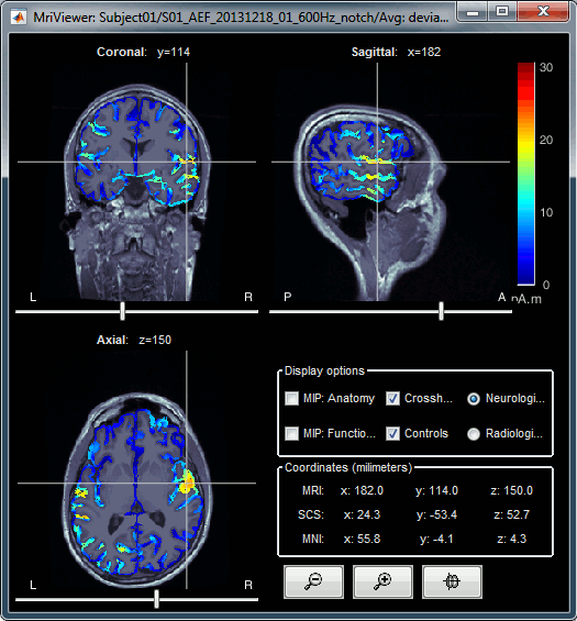 display_mriviewer.gif