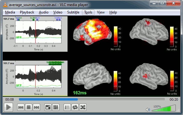 http://neuroimage.usc.edu/wikidocs/average_sources_unconstr.avi