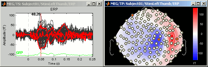 channelSelection.gif