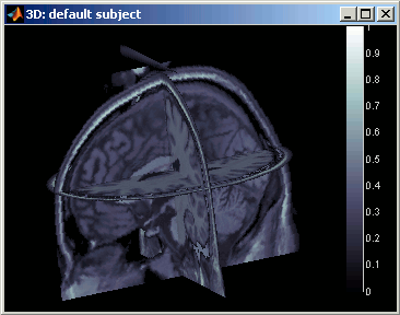 mriSlices3d.gif