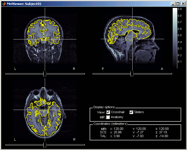 checkMriRegistration.gif