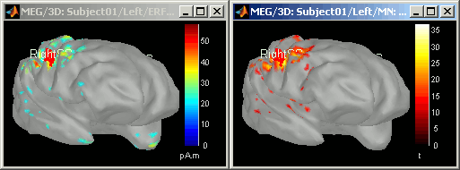 zscore_cortex.gif