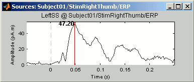 optionsMax.gif