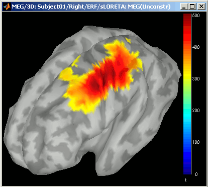 compLORETA.gif