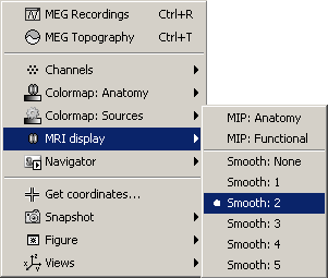 popupFigMri.gif