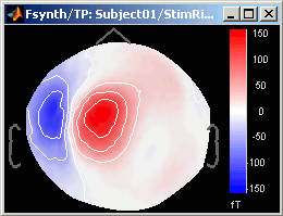 topoModelized.gif