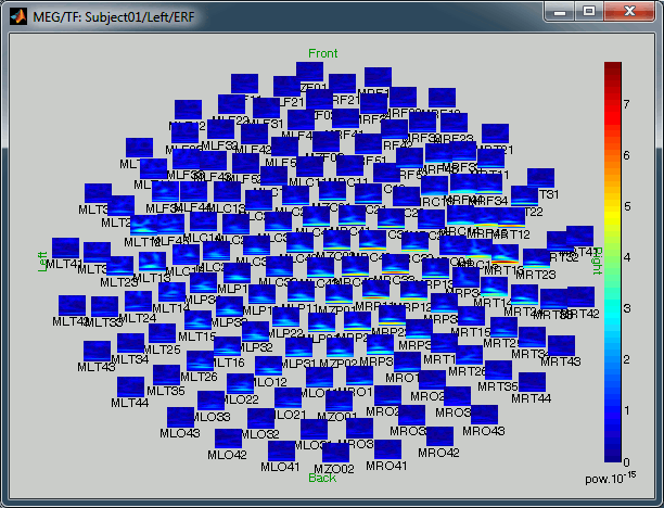 timeFreqAllSensors2.gif