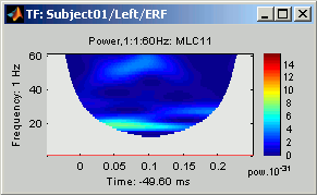 timeFreqHide.gif