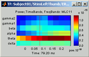 timeFreqTimeBand.gif