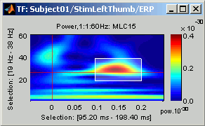 timefreqSelection.gif