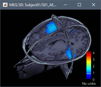 mri3d.gif