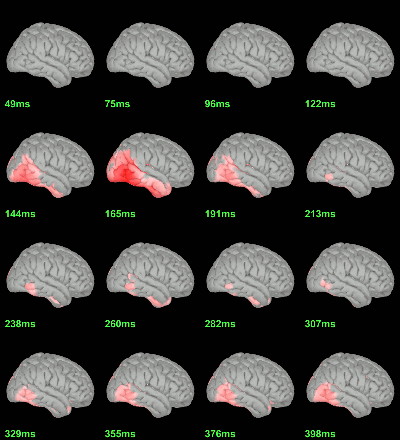 sources_ttest_eeg_right.gif