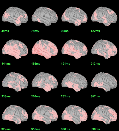 sources_ttest_eeg_right.gif