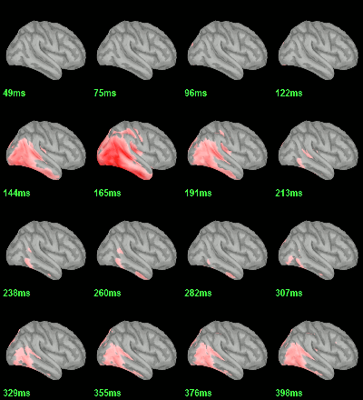 sources_ttest_eeg_right.gif