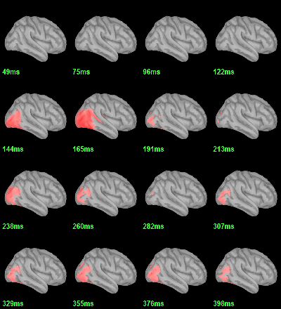 sources_diffmean_eeg_right.gif