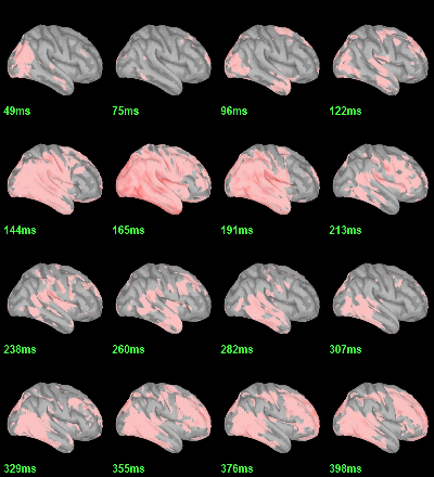 sources_ttest_eeg_right.gif