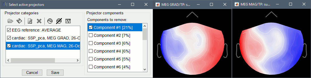 ssp_ecg_topo.gif