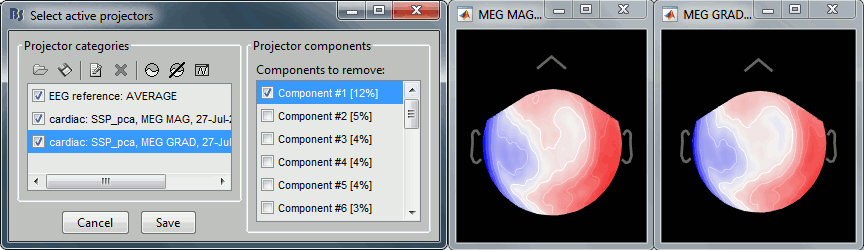 ssp_ecg_topo.gif