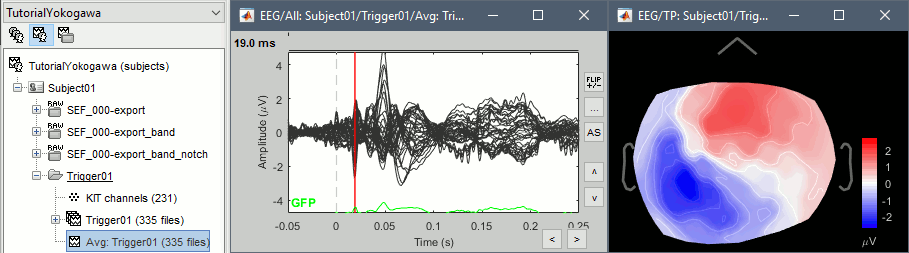 average_result_eeg.gif