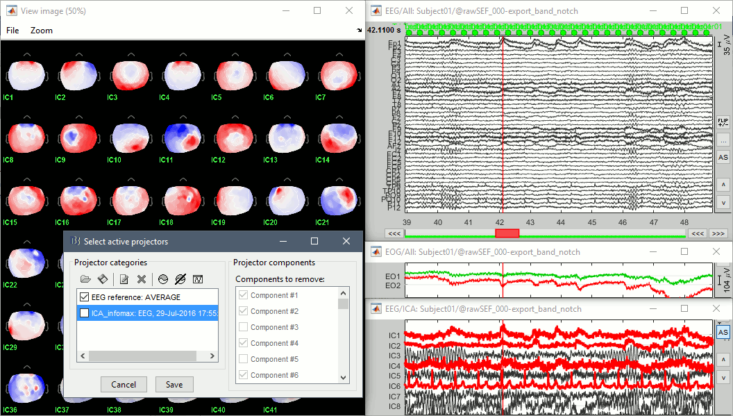 ica_eeg_result1.gif