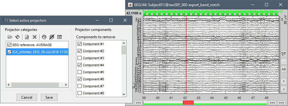 ica_eeg_result2.gif