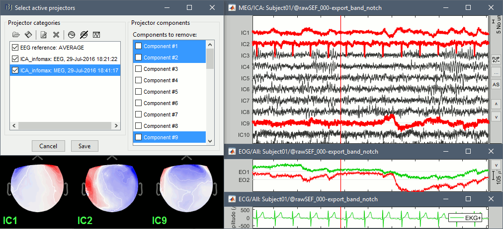 ica_meg_result1.gif