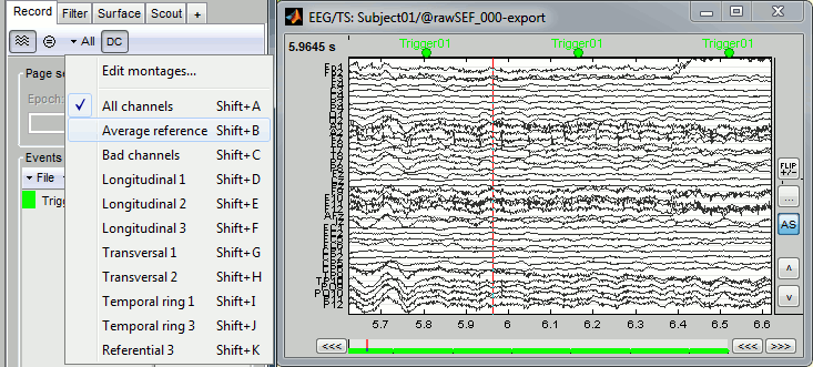 review_eeg.gif