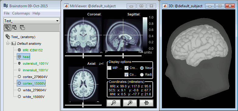 test_bst_brainsuite.gif