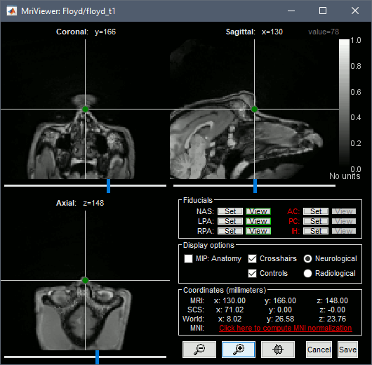 floyd_mri.gif