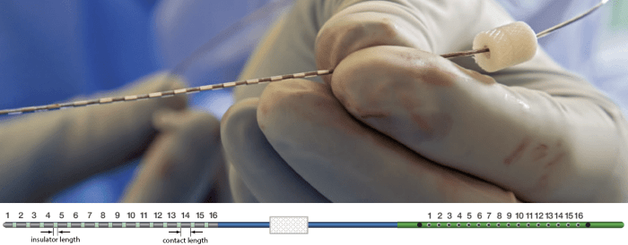 https://neuroimage.usc.edu/brainstorm/Tutorials/SeizureFingerprinting?action=AttachFile&do=get&target=pmt.png