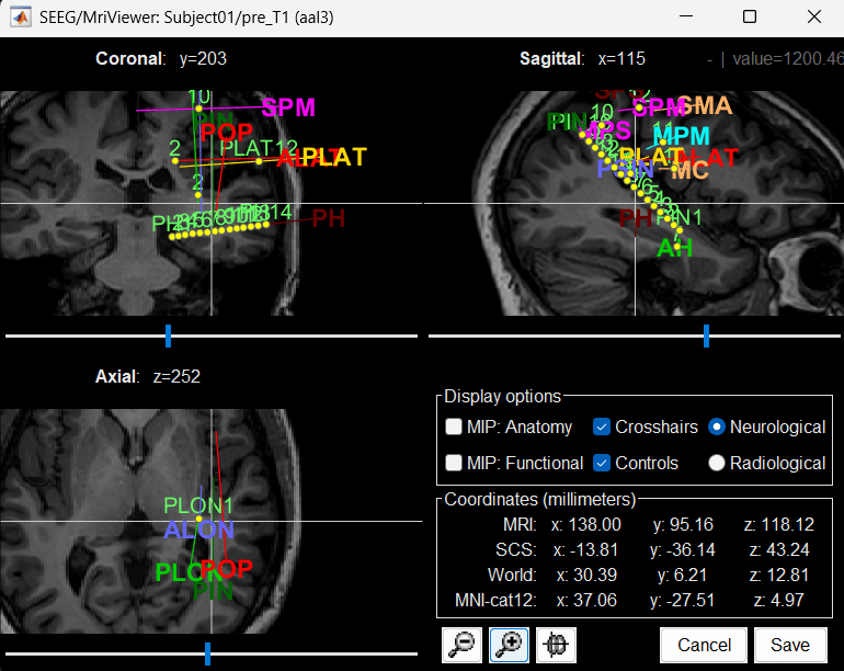 26_display_mri.png