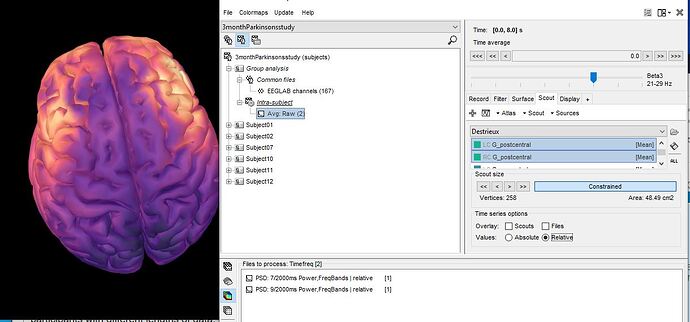 Brain frequency map