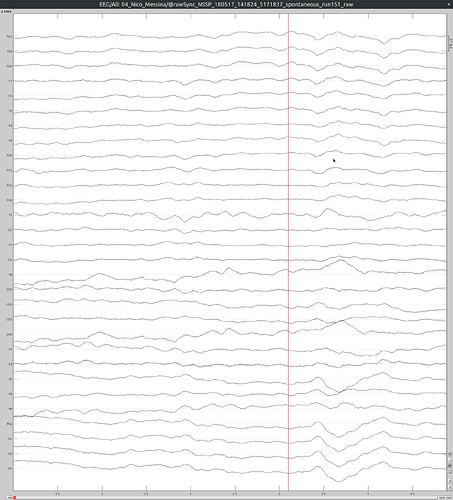 timeseries-halfscreen-incorrect