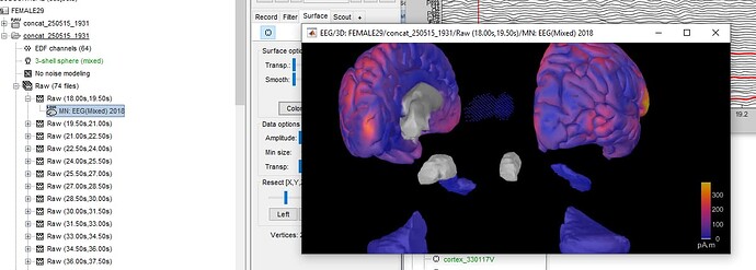 brainstoemerror