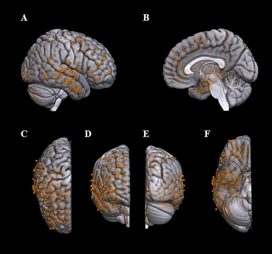 Figure 1.3 TheBigOne