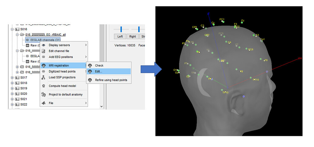 Sharepoint Mri Edited the MRI registration - Discussions - Brainstorm
