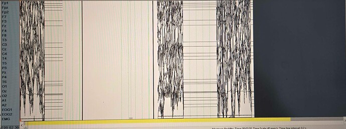 Stellate_after_bugfix
