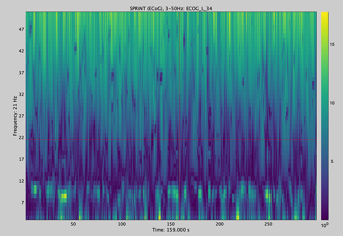 ECOG_TF_Subject02_raw_ecog34_sub2_SPRiNT_ECoG__3-50Hz