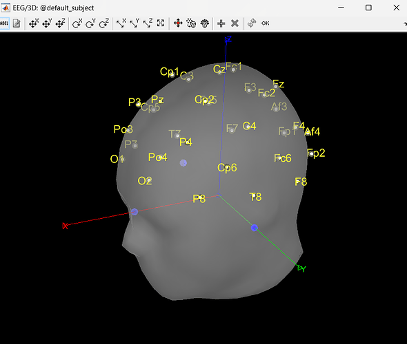 Electrodes position bsm