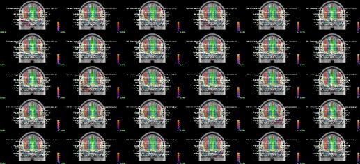 Contact_sheet__EEG_3D_