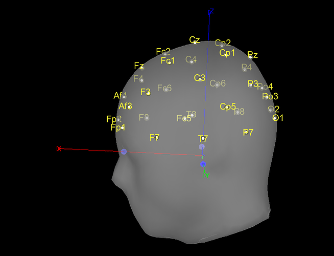 Electrodes position bsm