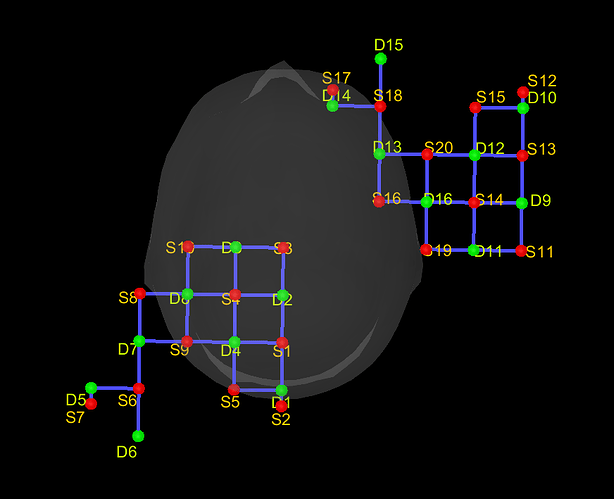 NIRS-BRS_3D_@default_subject