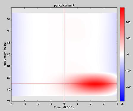 TF_Group_analysis_@intra_Avg_@intra_22_022