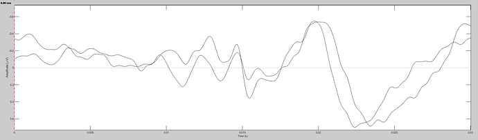 EEG_All_TEST_ABR