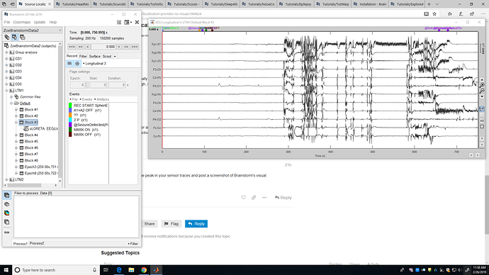 EEGpeak