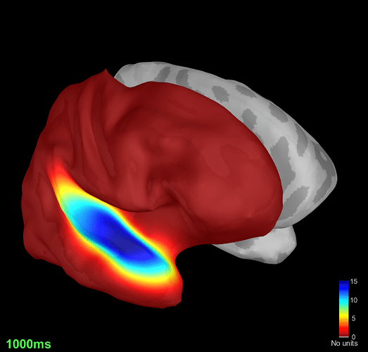 ADC_V_3D_Subject01_01_Subject01-01_AEF_20150112_04_2400_notch_band_02_clean_S1D1_smooth_take8-M100-peak-GAUSSIAN__abs__ssmooth3