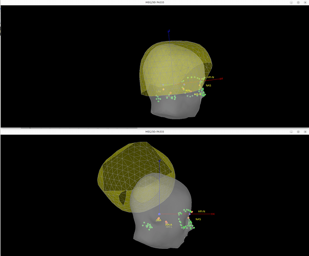 headmotion_correction_CTF