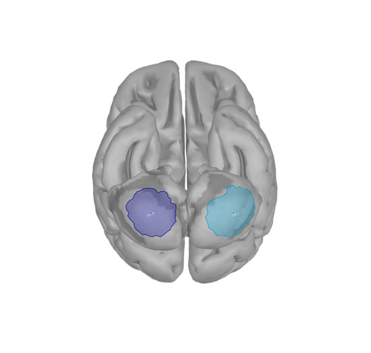 bilateral cerebellum
