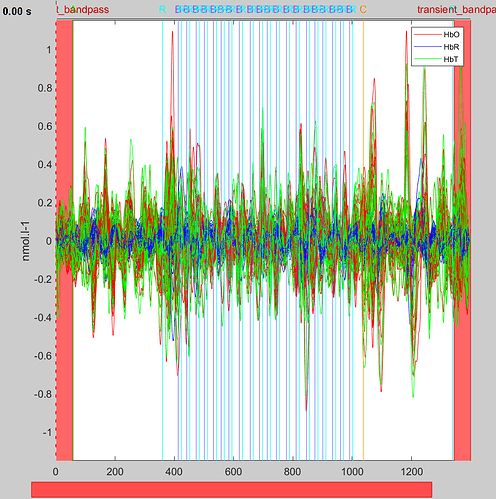 NIRS_All_Subject19_@rawQL_dOD_motioncorr_IIR-band_scr_Hb